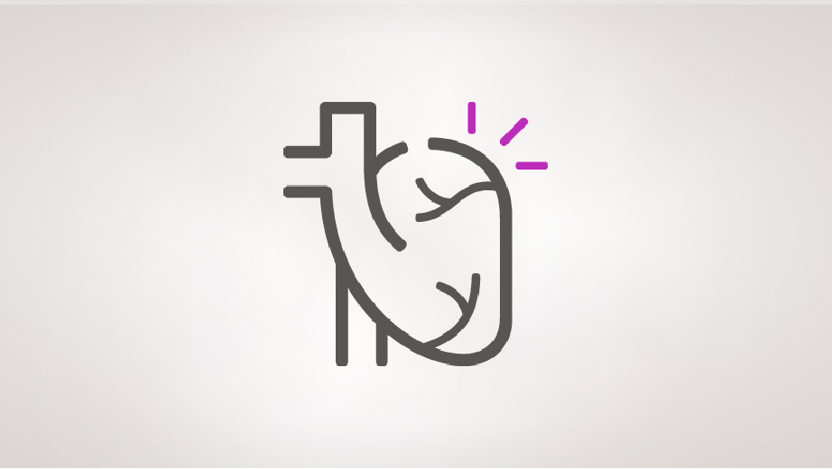 Cardiovascular